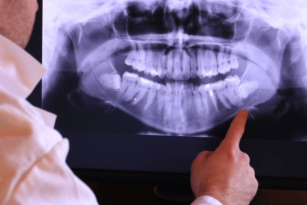 Best Teeth Whitening  in Robertsville, NJ